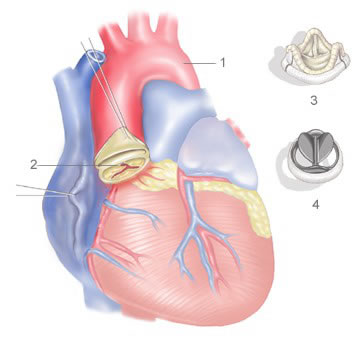 Heart valve diagram